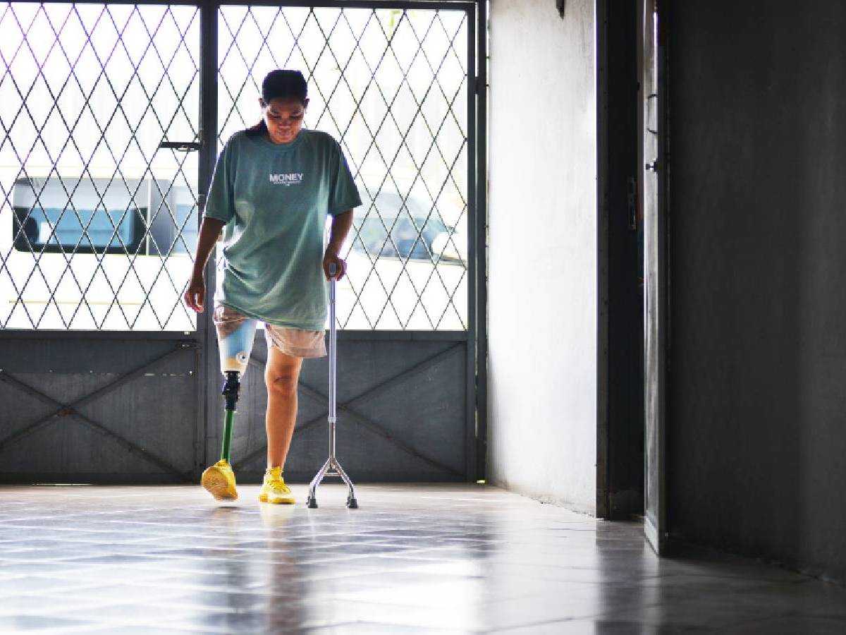 Walking Back to Life with a Prosthetic Leg