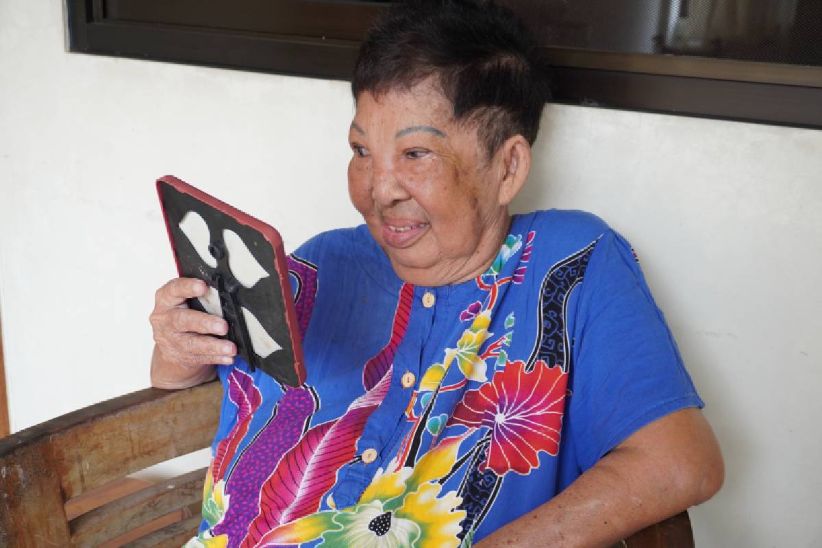 Kejutan Manis yang Didapat Oma Tan Setelah Operasi Katarak