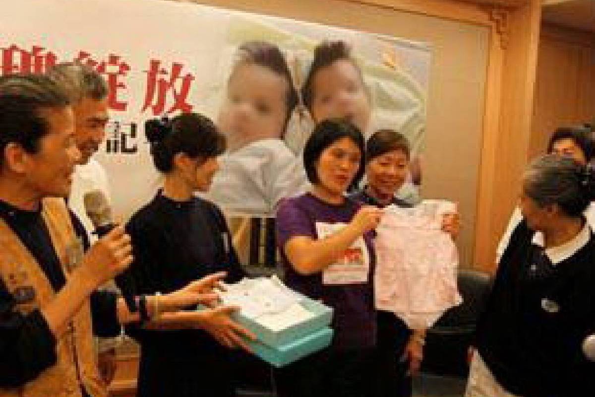 Internasional: Operasi Bayi Kembar Siam