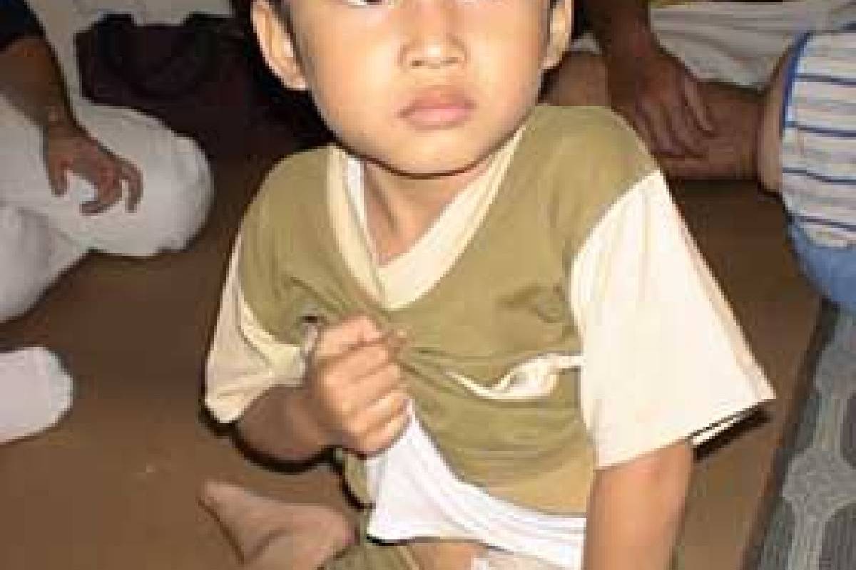 Penanganan Pasien Aditia Arrazi 5 tahun Penderita <em>HICSPRUNG DISEASE</em>